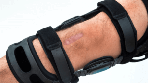 black hiking knee braces